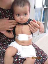 Tran, post-surgery and healthy!