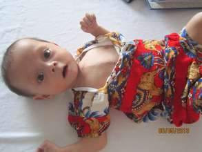 Baby An, post-surgery--healthy and pink!