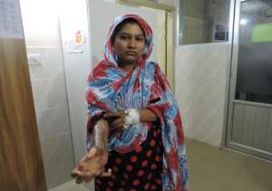 Hamida Before Surgery