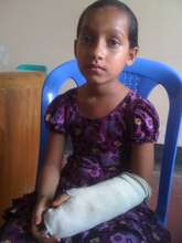 Murshida, Burn Patient