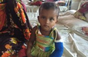Please Help 50 Children Suffering from Severe Burn