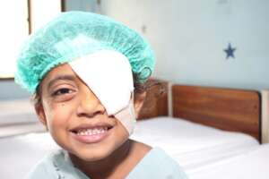 Naz post surgery