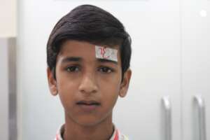 Hamza before surgery