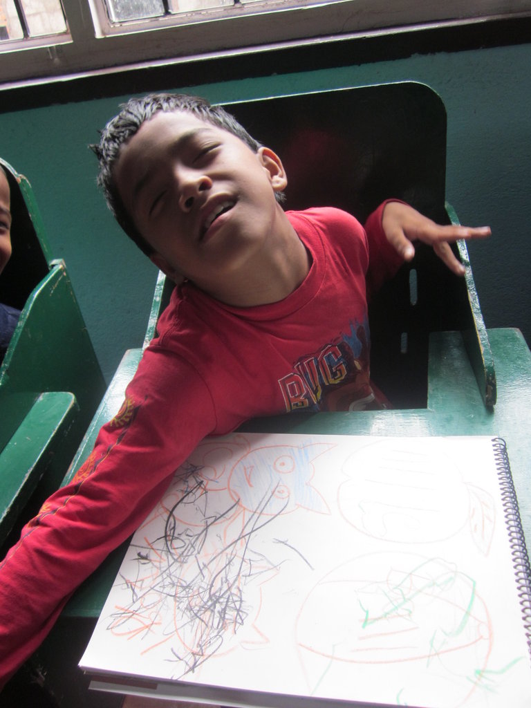 Rehabilitation for 50 Children with Disabilities