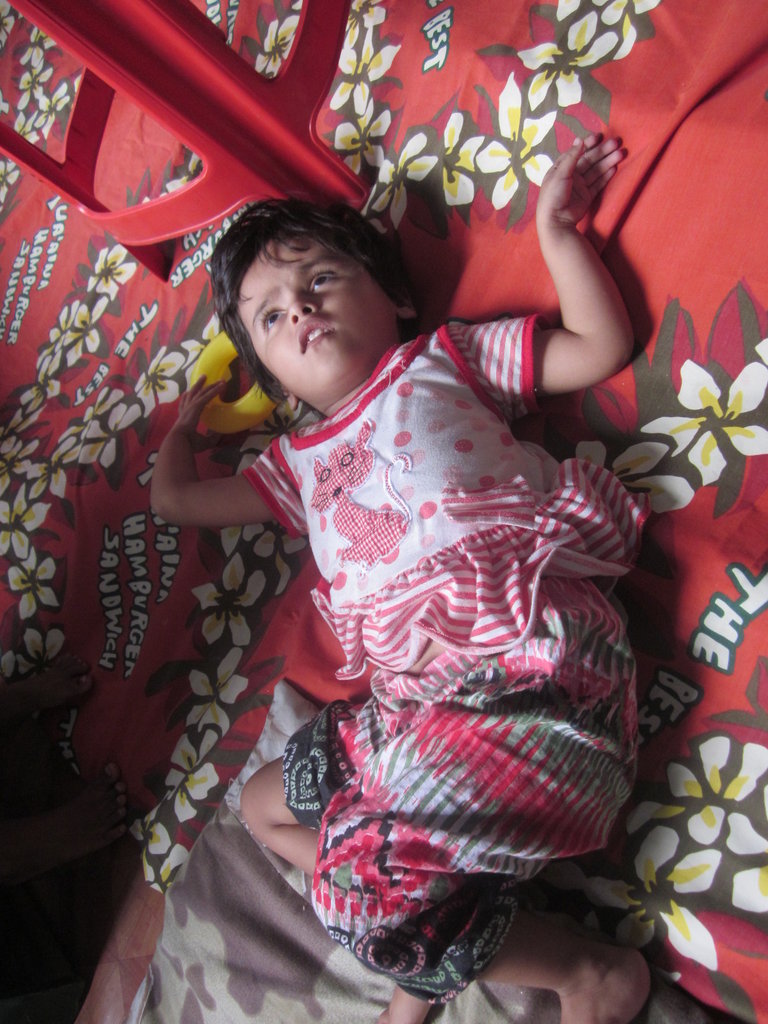 Rehabilitation for 50 Children with Disabilities