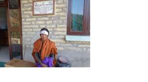 Forehead laceration w. glass splinters