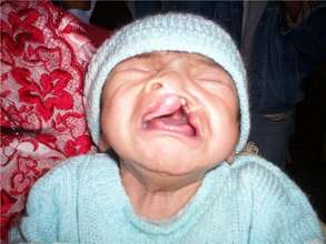 Leonel at birth