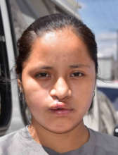 Susana after surgery
