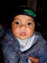 Darwin at 6 months, after his first surgery