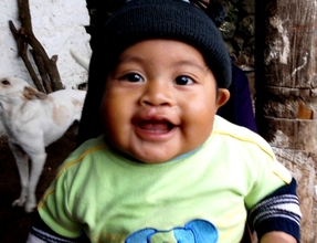 Salvador - after surgery