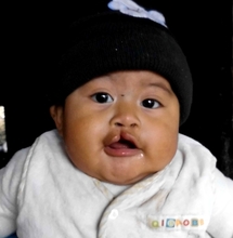 Salvador - before surgery