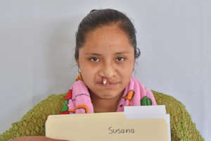Susana before surgery