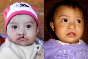 Astrid, before and after