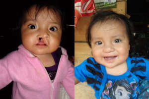 Elda, before and after