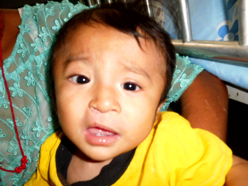 Surgery for Guatemalans with Cleft Lip and Palate