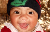 Surgery for Guatemalans with Cleft Lip and Palate