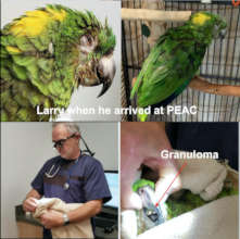 51 YR OLD LARRY BEFORE HIS SURGERIES