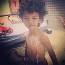 Before Surgery