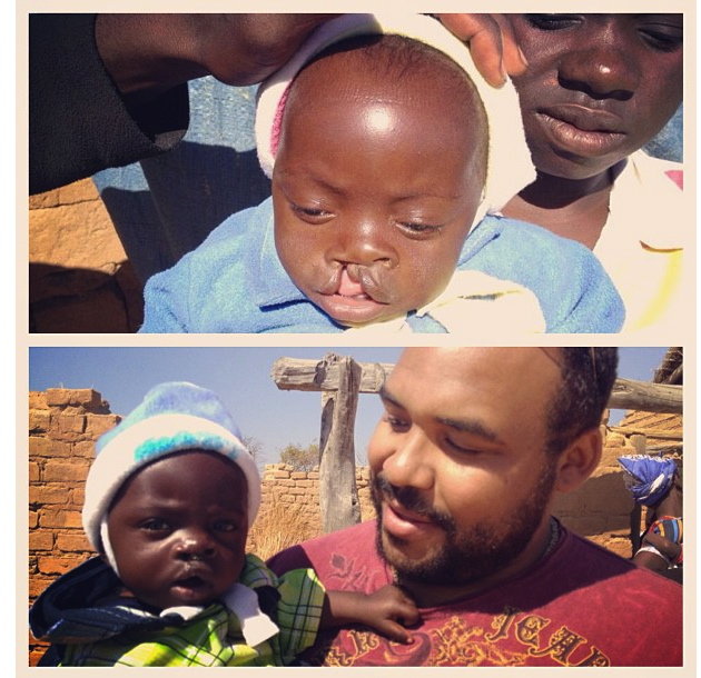 Improving Access to Healthcare in Rural Zambia