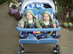 Twins babies after fetoscopy