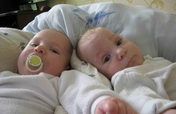 Help to save twins lives by fetoscopy in Ukraine!