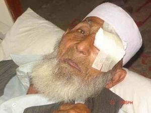 Provide Free Eye Care in a Pakistani Eye Hospital