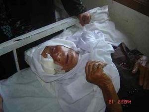 Provide Free Eye Care in a Pakistani Eye Hospital