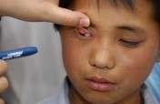Help blind children in Inner Mongolia, China