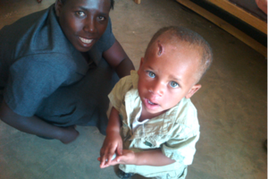 Our latest rescued albino child and his mother