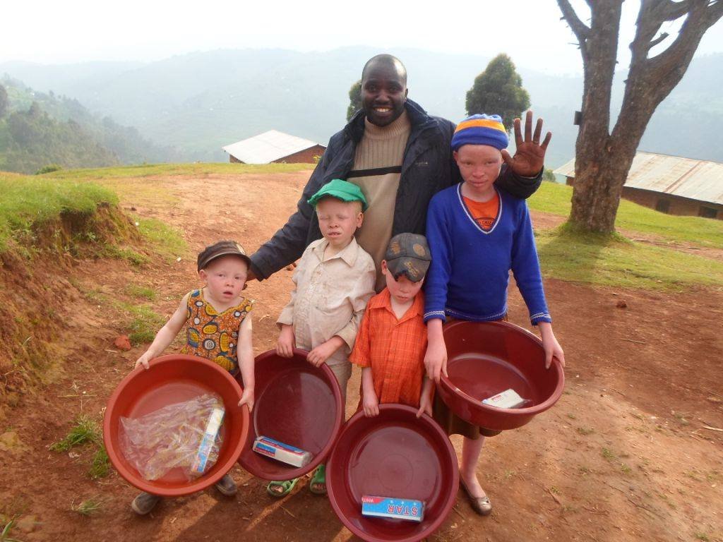 Help 10 Albino Children Saved from Sacrifice