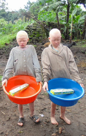 Help 10 Albino Children Saved from Sacrifice