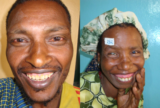 Patients in Western Ethiopia