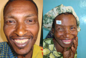 Patients in Western Ethiopia