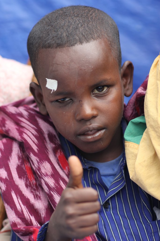 Outreach Eye Camps in Ethiopia