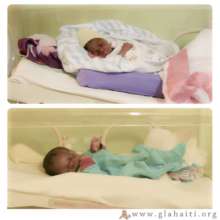 Two of the 8 babies admitted for help in last 2 mo