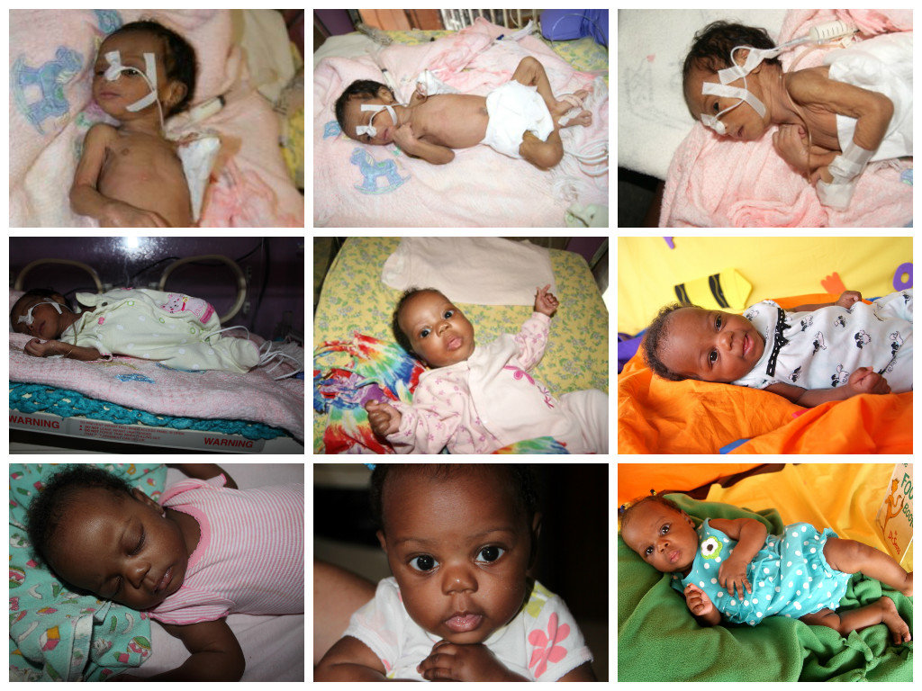 Formula for Babies at an Orphanage in Haiti