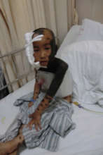 2012 - Post First Surgery