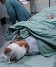 Haobo After His First Surgery