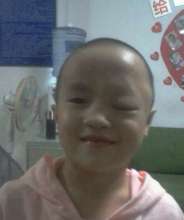 2013 Two-Month After Her Tumor Was Removed
