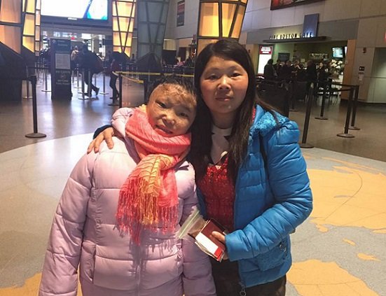 2019 Xueting leaving Boston after 5mos treatments