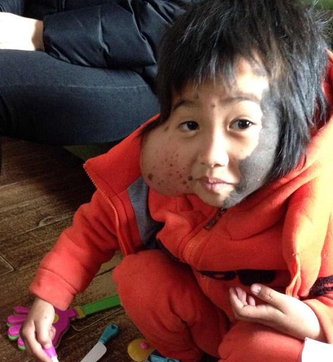 Medical Fund for Needy Chinese Children