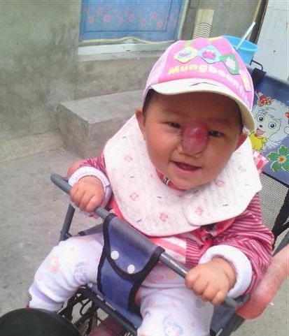 Medical Fund for Needy Chinese Children