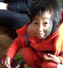 Jiangli was born with a huge mole