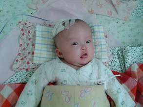 Jiawei had multiple surgeries since she was born