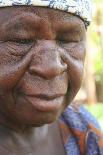 Health care for 30,000 slum residents in Mali