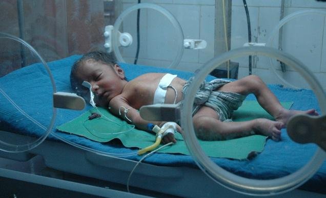 Baby Incubators Needed in India