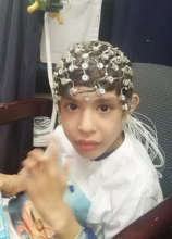 Max getting an EEG at the dup15q clinic.