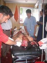Badly Injured Auto Accident Victim