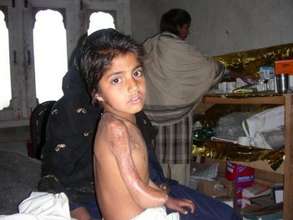 Little Girl In Need of Treatment, Physical Therapy