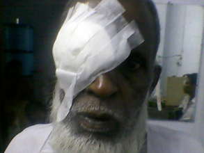 An elderly patient after a free cataract surgery